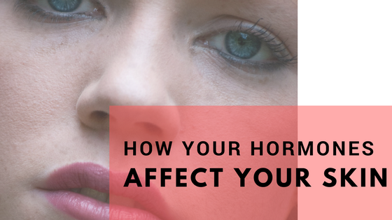 How your Hormones Affect your Skin